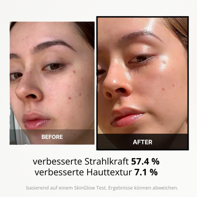SkinGlow I 6-in-1-Gesichtsbehandlung